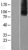 SLC28A2 Protein (Over-Expression Lysate Myc-DDK (Flag))