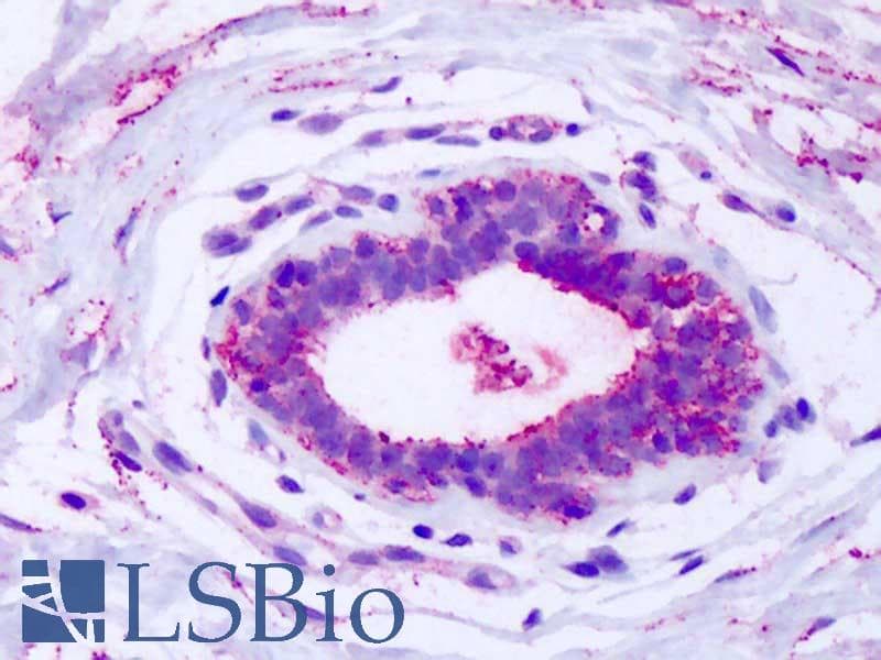 IHC-plus™ GPR80 / GPR99 / OXGR1 Antibody (Extracellular Domain)