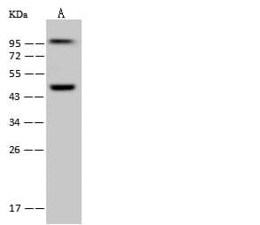 Polyclonal Rabbit anti-Human WDR4 Antibody (IHC, WB)
