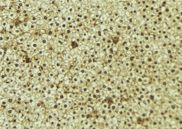 WWP1 Antibody