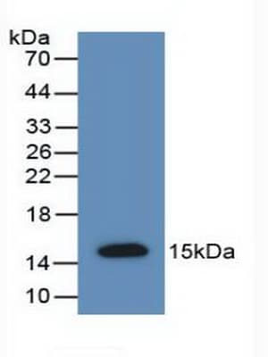 AMH / Anti-Mullerian Hormone Antibody (aa447-553)