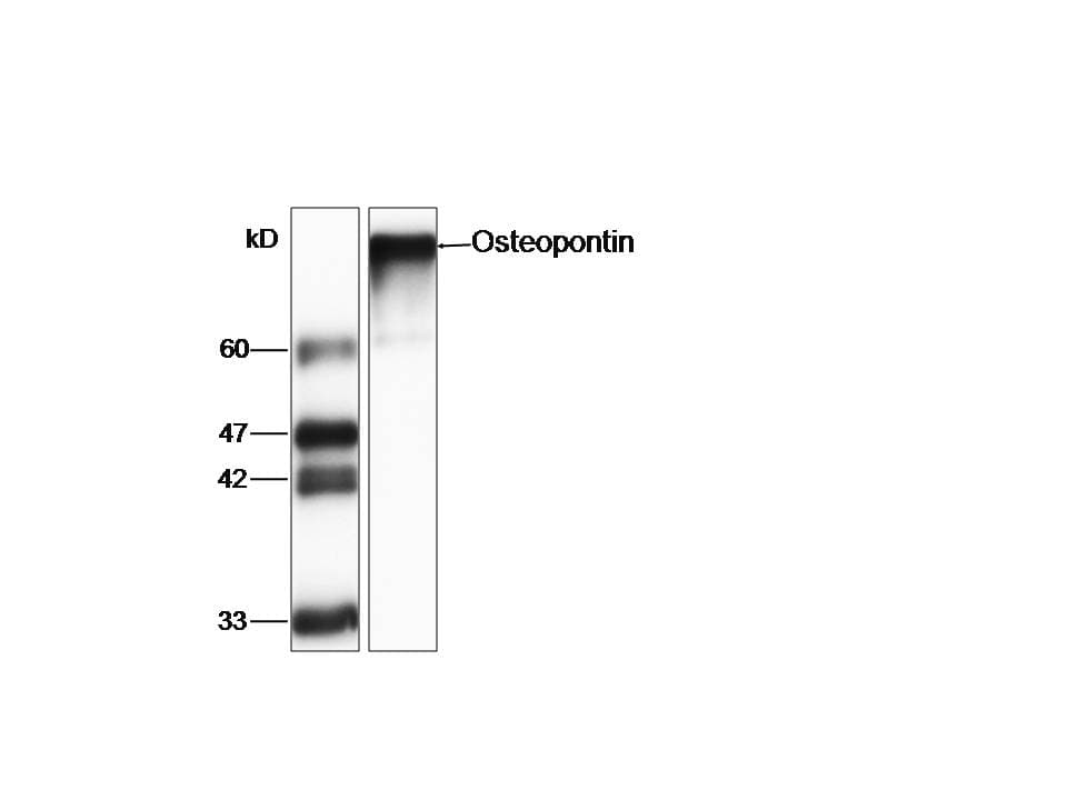 SPP1 / Osteopontin Antibody (aa17-314)