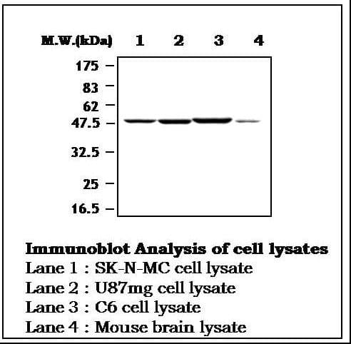 IHC-plus™ Polyclonal Rabbit anti-Human MAPT / Tau Antibody (IHC, WB)