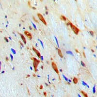 IHC-plus™ STAT1 Antibody (Internal)