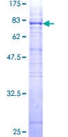 Human MYOC / Myocilin Protein (Recombinant GST)