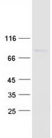 Human PAN3 Protein (Recombinant Myc-DDK (Flag))