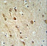 ZRANB1 / TRABID Antibody (aa665-692)
