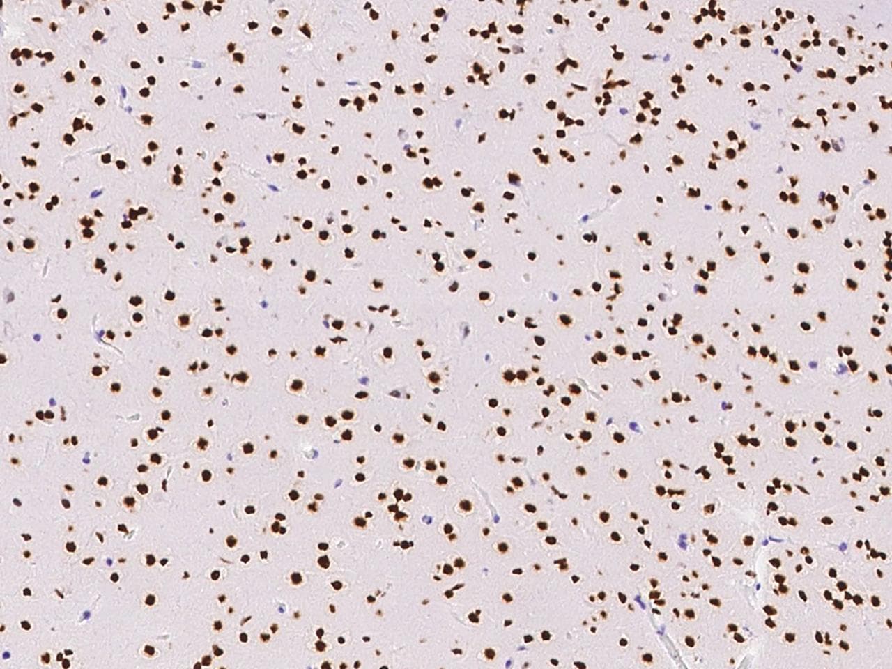 ONECUT1 / HNF6 Antibody (Preservative Free)
