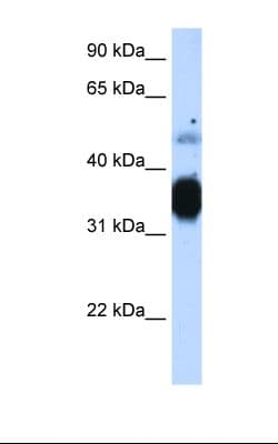 TNNT3 Antibody (aa31-80, HRP)