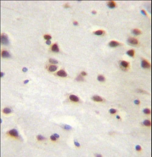 Polyclonal Rabbit anti-Human ANKRD6 / Diversin Antibody (aa314-343, IHC, WB)