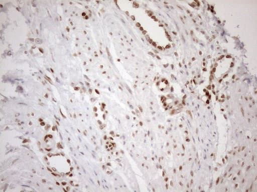 Monoclonal Mouse anti-Human MGMT Antibody (clone OTI2F10, Carrier-free, IHC, WB)