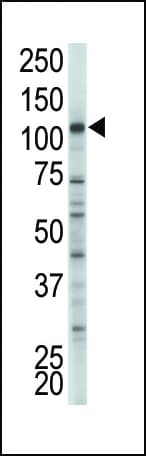 HK2 / Hexokinase 2 Antibody (aa401-431)