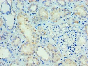 SMAD9 Antibody (aa1-300)