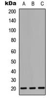 CD247 / CD3 Zeta Antibody (Internal)