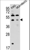SNX29 / RUNDC2A Antibody (aa710-739)