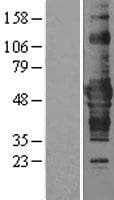 ZNF843 Protein (Over-Expression Lysate Myc-DDK (Flag))