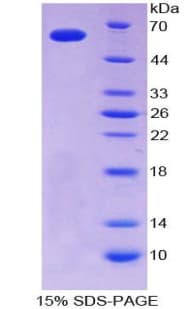 Human CD40L Protein (Recombinant His-GST)