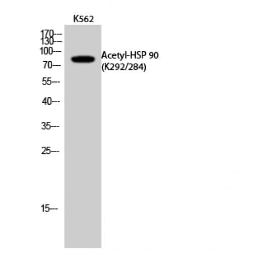HSP90 / Heat Shock Protein 90 Antibody (acetylation site of K292/284.)