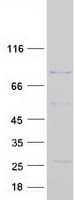Human DGKB / DGK Beta Protein (Recombinant Myc-DDK (Flag))