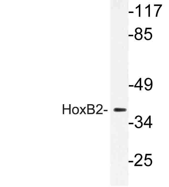 HOXB2 Antibody (Pro67)