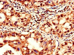 Polyclonal Rabbit anti-Human YTHDF2 Antibody