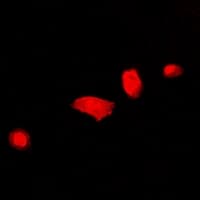 Polyclonal Rabbit anti-Human DCAF7 / WDR68 Antibody (IF, WB)
