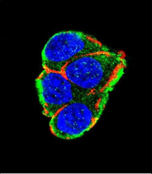 AKT2 Antibody