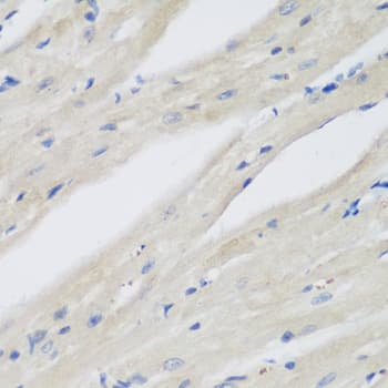 NAA50 / NAT13 / SAN Antibody