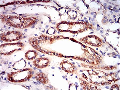 IHC-plus™ PRKAG1 / AMPK Gamma 1 Antibody (aa230-331, clone 7H3E9)