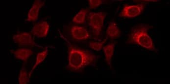 Polyclonal Rabbit anti-Human RAN Antibody (IHC, IF, WB)