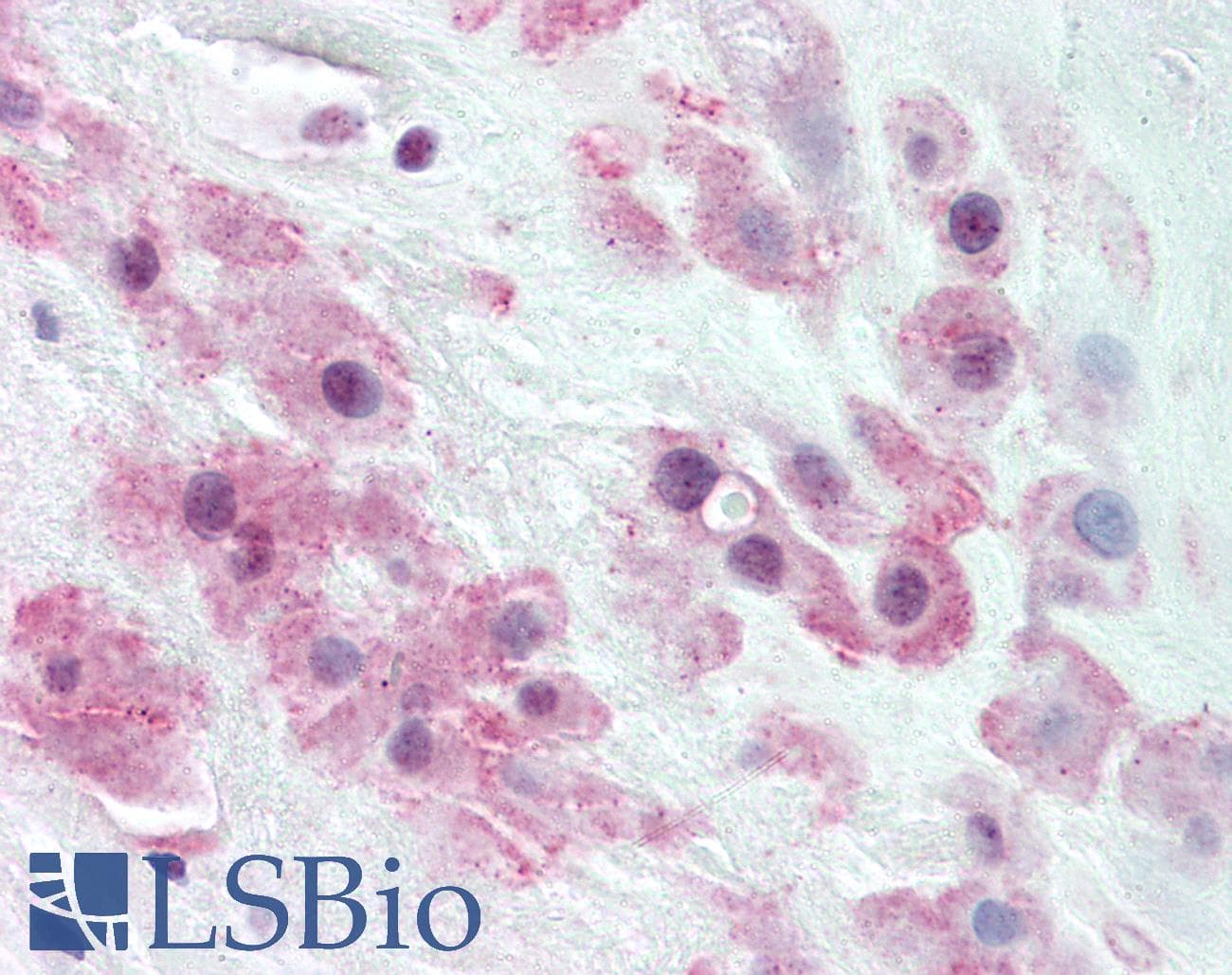 IHC-plus™ Polyclonal Rabbit anti-Human TJP2 / ZO2 / ZO-2 Antibody (C-Terminus, IHC, IF, WB)