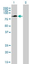 IHC-plus™ IFI16 Antibody (clone 2E3)
