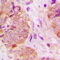 Polyclonal Rabbit anti-Human GSPT1 Antibody (Internal, IHC, WB)