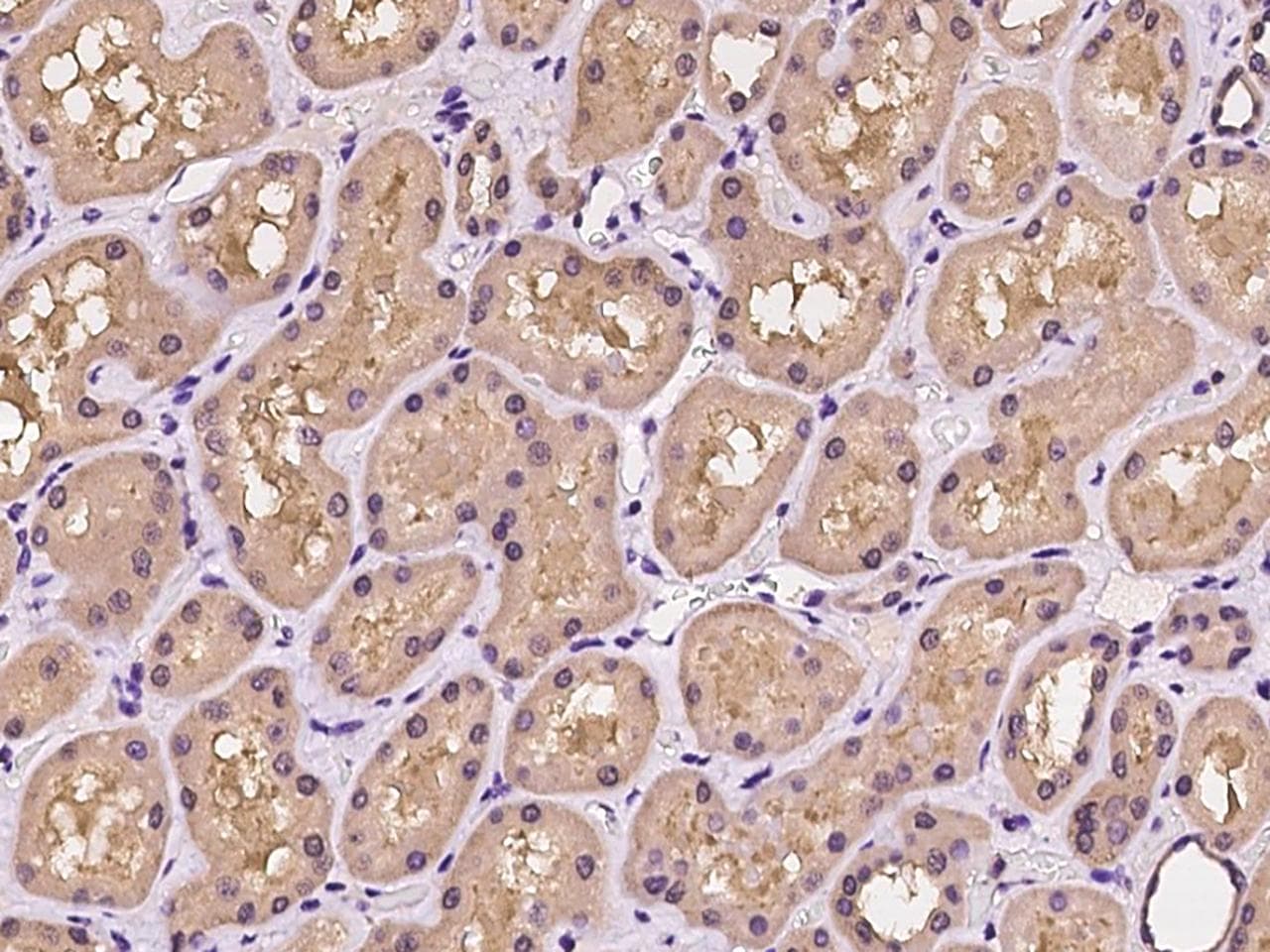 TBCA Antibody