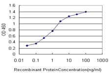 IHC-plus™ FOXA1 Antibody (clone 4F6)