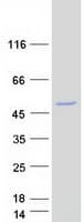 Human CABYR Protein (Recombinant Myc-DDK (Flag))