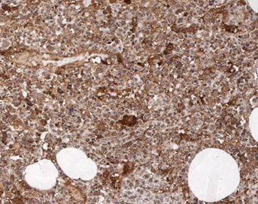 P2RY12 / P2Y12 Antibody