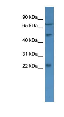 Polyclonal Rabbit anti-Human GCAP2 / GUCA1B Antibody (aa34-83, WB)