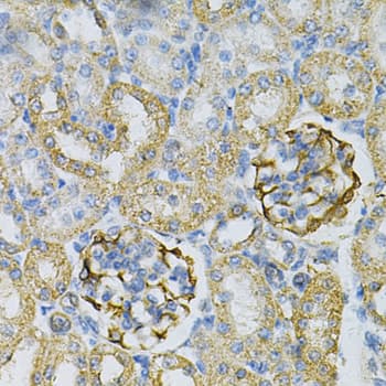 AK1 / Adenylate Kinase 1 Antibody