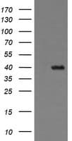 THUMPD1 Antibody (clone OTI1H6)