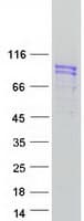 Human UNC84B / SUN2 Protein (Recombinant Myc-DDK (Flag))