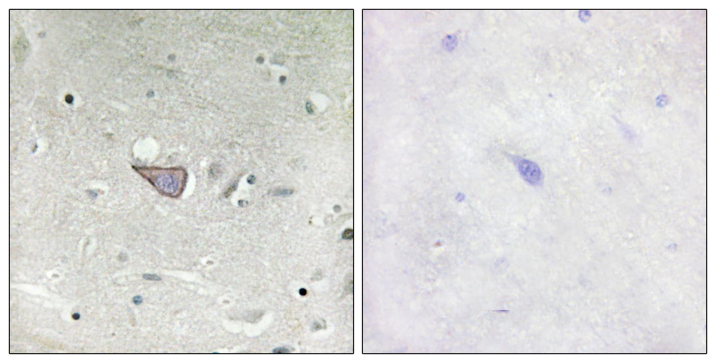 Polyclonal Rabbit anti-Human ARMCX3 Antibody (aa291-340, IHC, IF, WB)