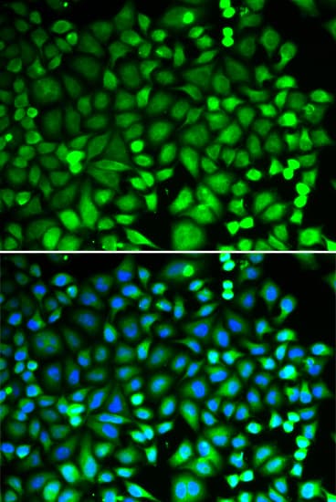 PSMB2 Antibody