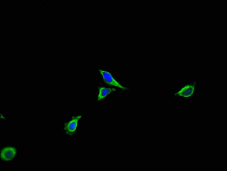 ACTR3 Antibody
