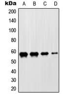 Polyclonal Rabbit anti-Human ZNF682 Antibody (N-Terminus, IF, WB)