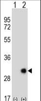 Polyclonal Rabbit anti-Human ETHE1 Antibody (aa103-130, IHC, WB)