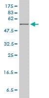 HPRT1 / HPRT Antibody (clone 4C3-G8)