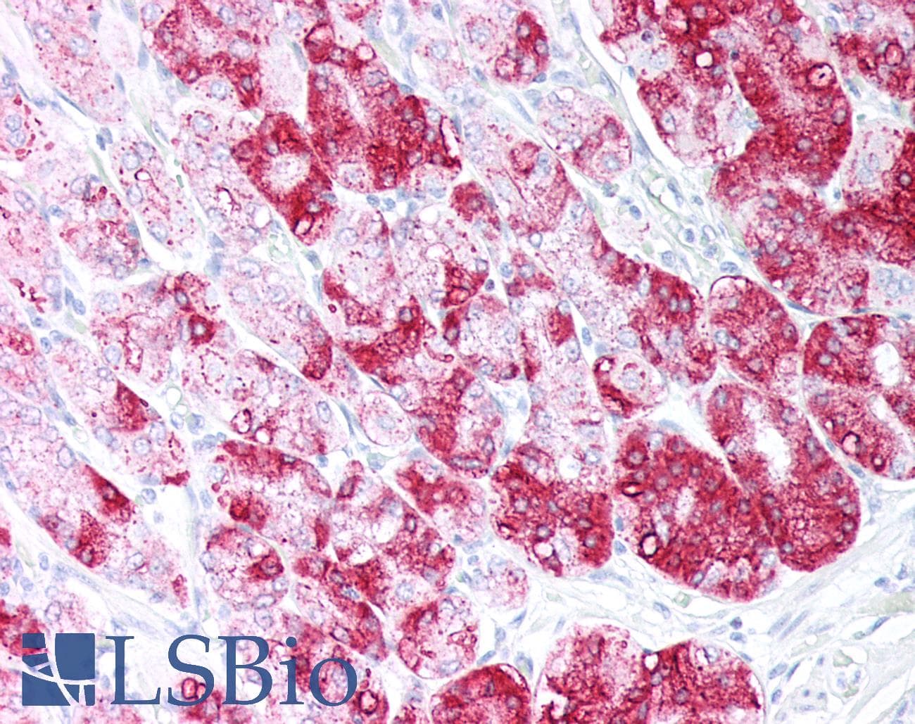 PathPlus™ EMA / MUC1 Antibody (clone ABT-EMA)