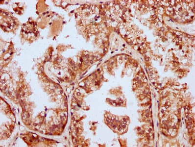 Polyclonal Rabbit anti-Human MBNL3 Antibody (IHC, IF)
