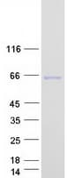 Human KLHL31 Protein (Recombinant Myc-DDK (Flag))